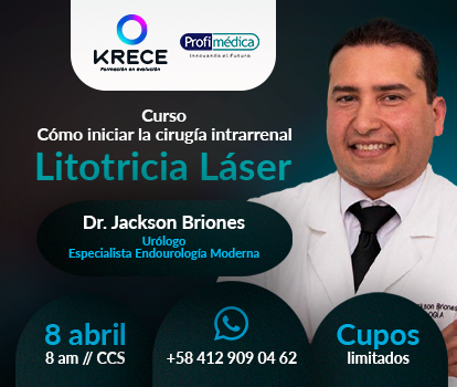 Litotricia laser