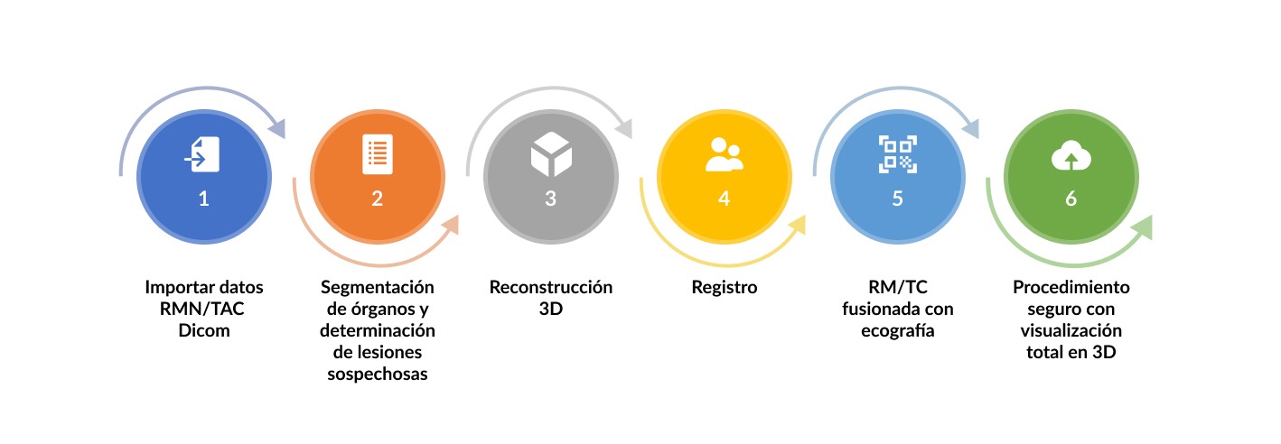 Venus Proceso de trabajo