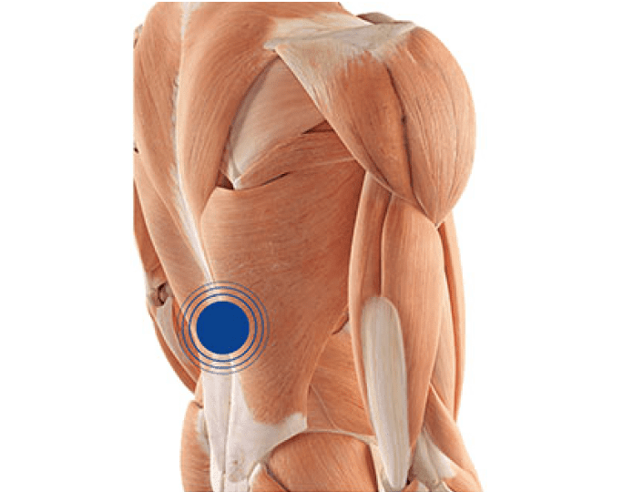 Dolor Pseudorradicular Lumbar