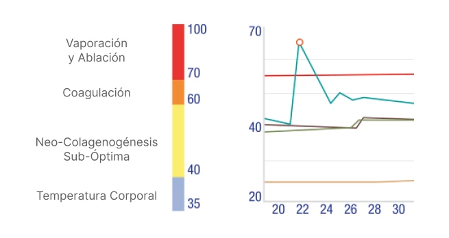 grafico ultraformer