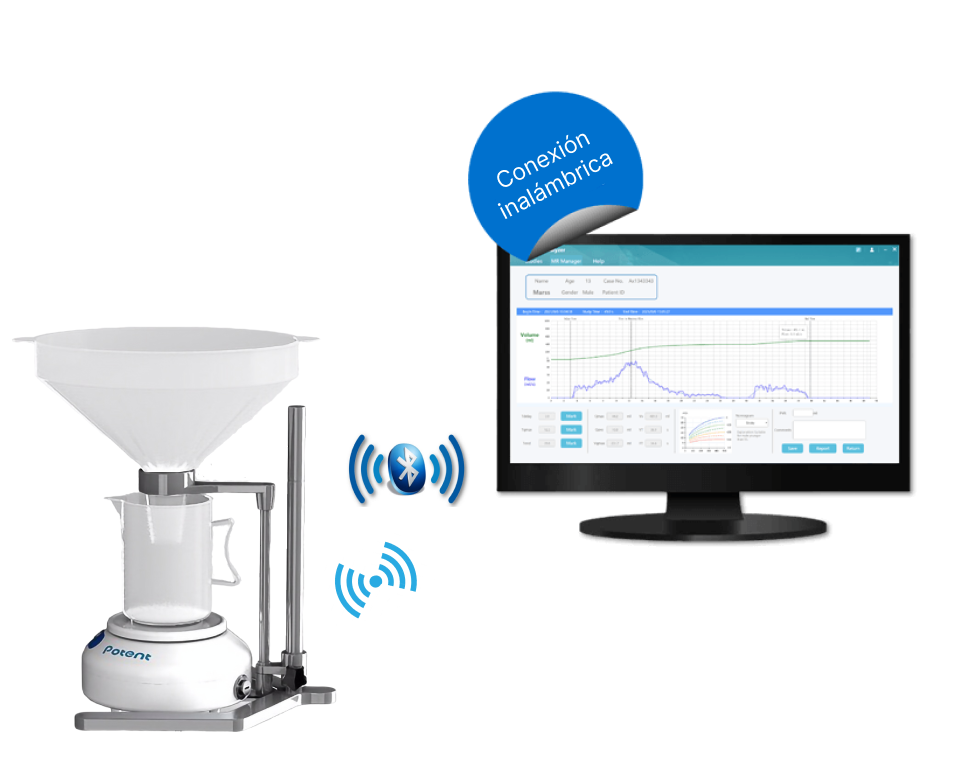 Uroflujometro inalambrico